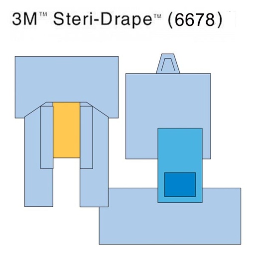 [MMM-6678] Cardiovascular Pack, 107" x 133" with 6677 Procedure Drape, Perineal/ Leg Sheet, Mayo Stand Cover & Back Table Cover, 4/cs