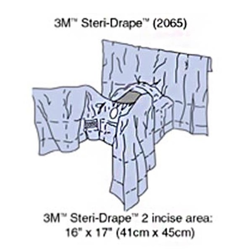 [MMM-2065] Steri-Drape™ Abdominal Perineal Drape with Incise Film, 160", Lithotomy Position, Absorbent Impervious Material, Incise Aperture, Perineal/ Vaginal Aperture, 4 Tube Organizer, 8/bx, 2 bx/cs